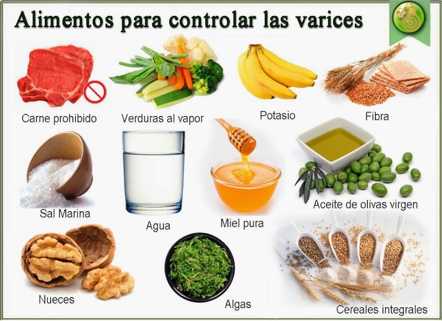 ▷ 10 Remedios caseros para las varices