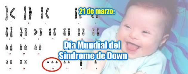 sindrome-down