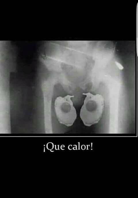 Imágenes chistosas de calor para compartir