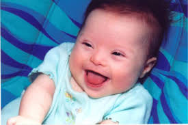 ▷ Imágenes de bebés con síndrome down