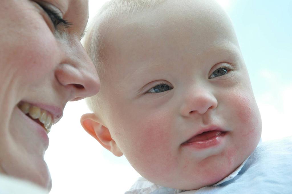 ▷ Imágenes de bebés con síndrome down