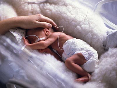 ▷ Imágenes de bebés prematuros