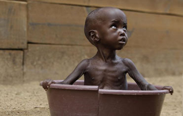 ▷ Imágenes de niños sufriendo